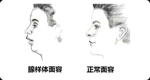 面容对比图