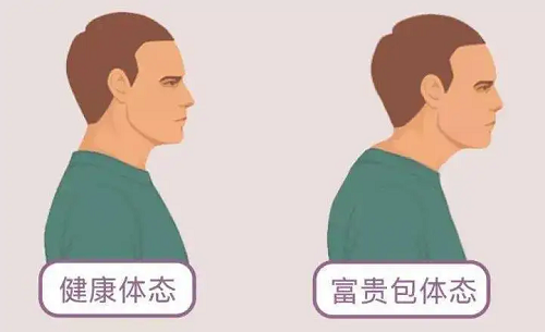富贵包体态对比图