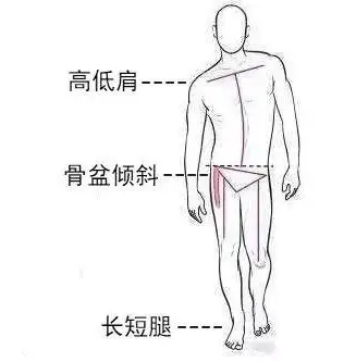 高低肩