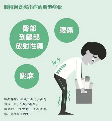 椎间盘突出典型症状