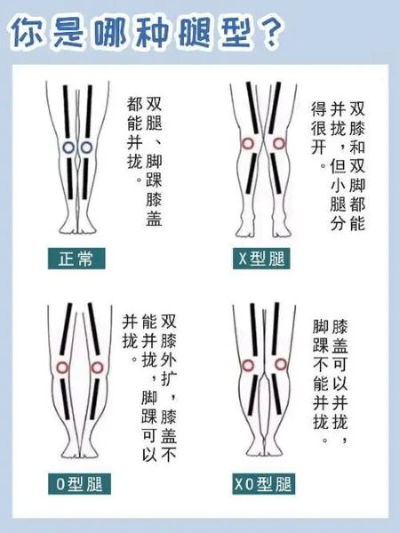 腿型分类