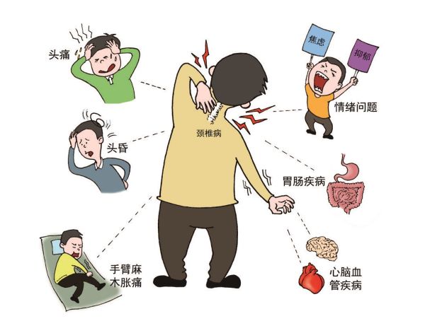 颈椎病症状