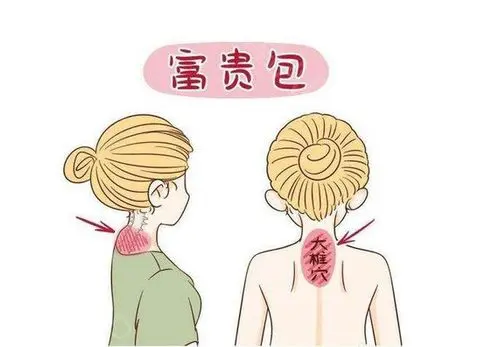 富贵包