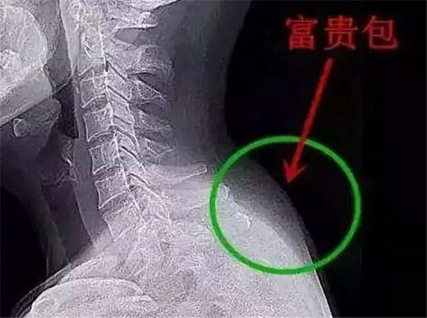 富贵包影像