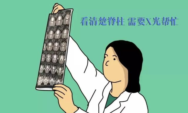 看清楚脊柱 需要x光帮忙