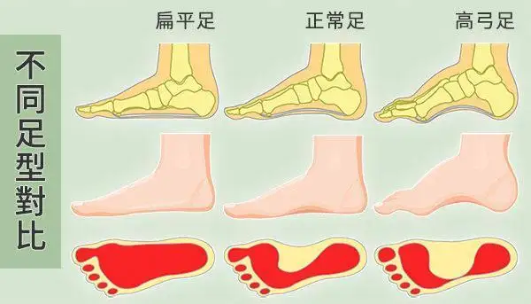 不同足型对比图