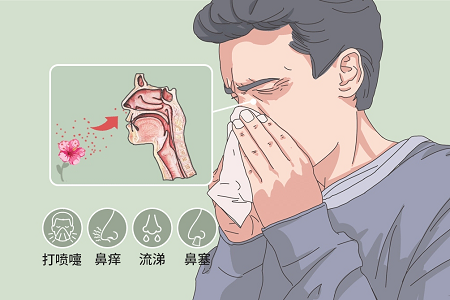 过敏性鼻炎症状
