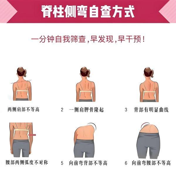 脊柱侧弯自查方式