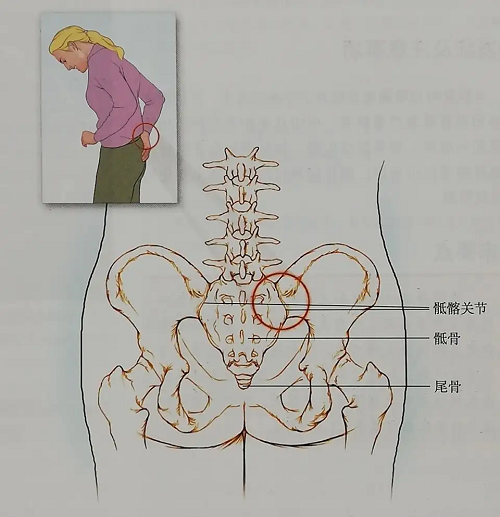 骶右后位图片图片